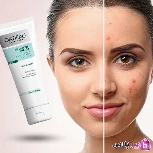 کرم بیوممتیک ژلی آنتی آکنه ضدجوش و ضدلک ۴۰ میل گاتیو ایتالیا