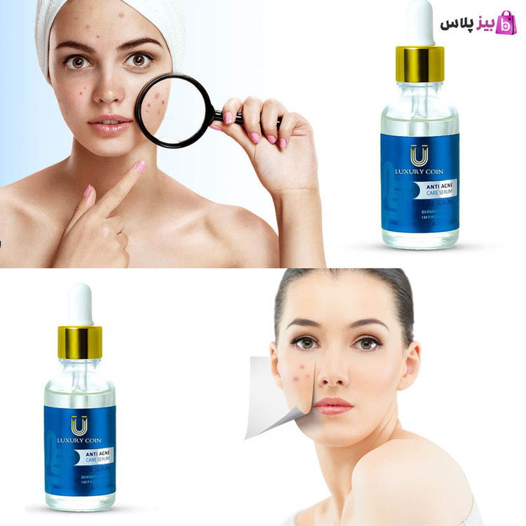 سروم بیوممتیک ضدجوش و لک وآکنه ۴۰میل لاکچری کوین فرانسه باضمانت بی قید و شرط